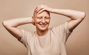 Frau mit Glatze streicht sich lachend über die Kopfhaut